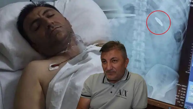 15 Temmuz'un İzleri: Vücudunda Kurşunla Taşıyanlar