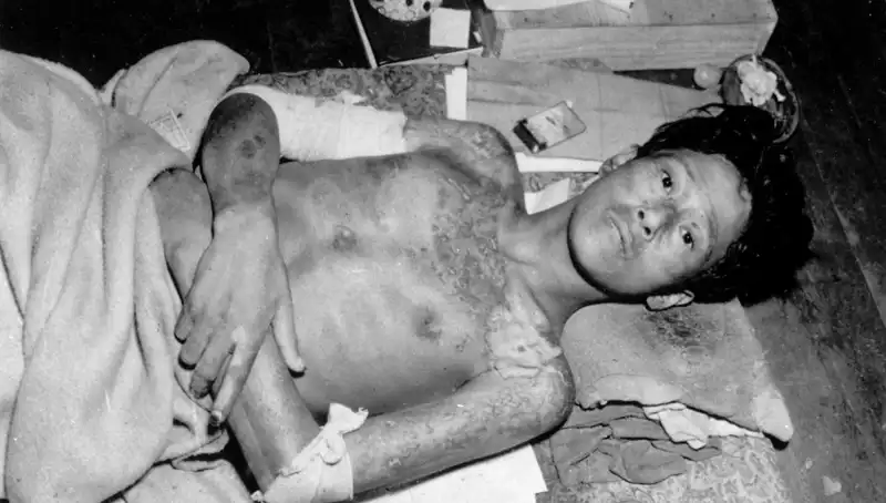 Nagasaki’den 80 Yıl Sonra Nükleer Felaket Uyarısı: Zaman Tükeniyor